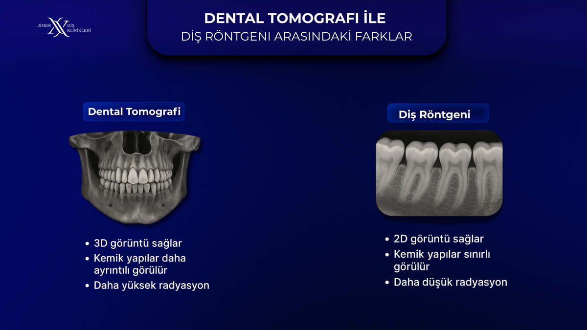 What are Volumetric Dental Tomography and Panoramic X-Ray? What are Volumetric Dental Tomography and Panoramic X-Ray?