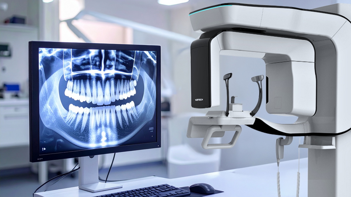 How is a Dental CT Scan Performed? How is a Dental CT Scan Performed?