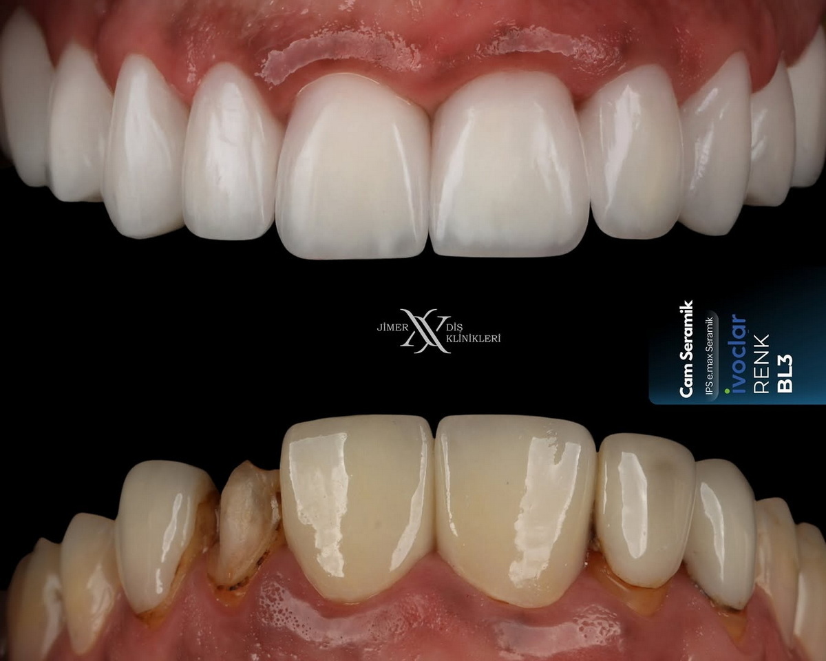 What is Cosmetic Dentistry? What is Cosmetic Dentistry?