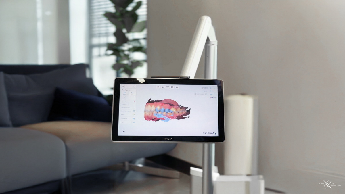 Bursa Digital Smile Design (DSD) and Planning Bursa Digital Smile Design (DSD) and Planning