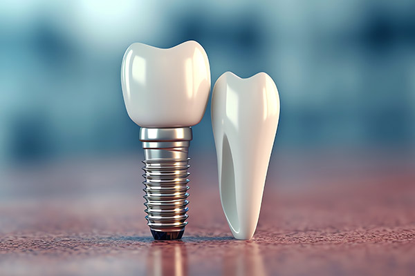 Implant