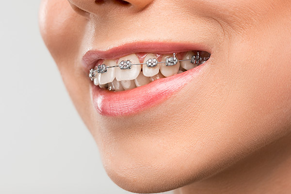 Orthodontics